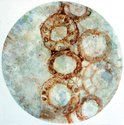 Nicola Gibbons, Kidney Cells, acrylic on canvas.